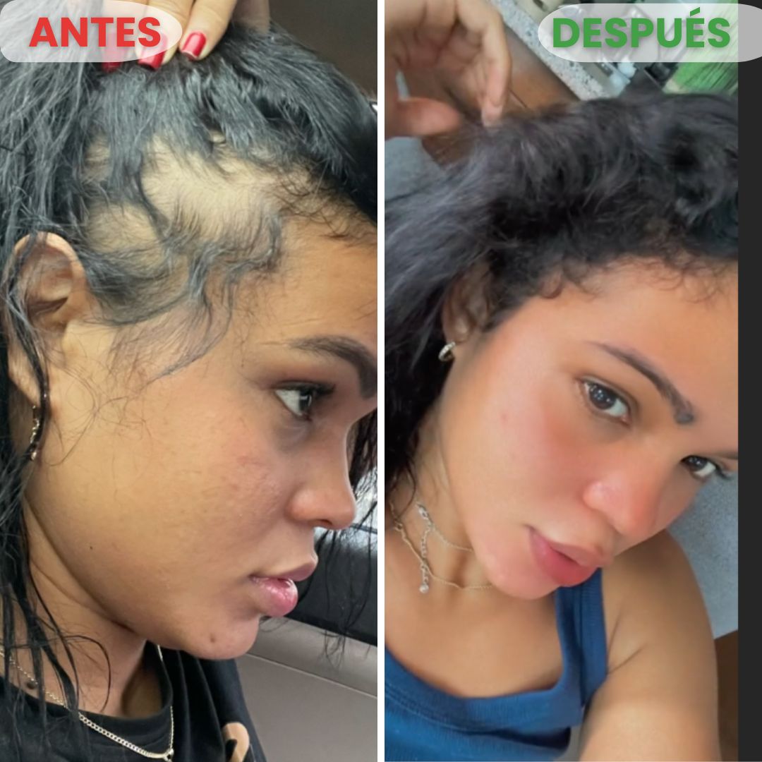 Champú Batana Revitalizante