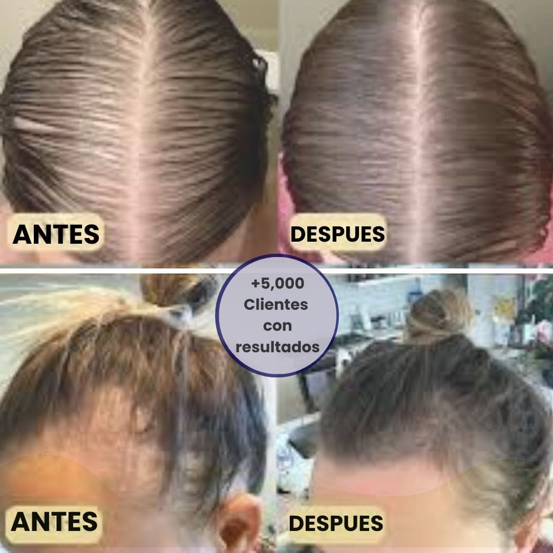 Champú Batana Revitalizante